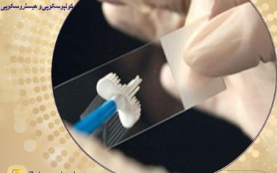هزینه تست پاپ اسمیر