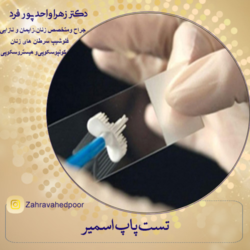 تست پاپ اسمیر