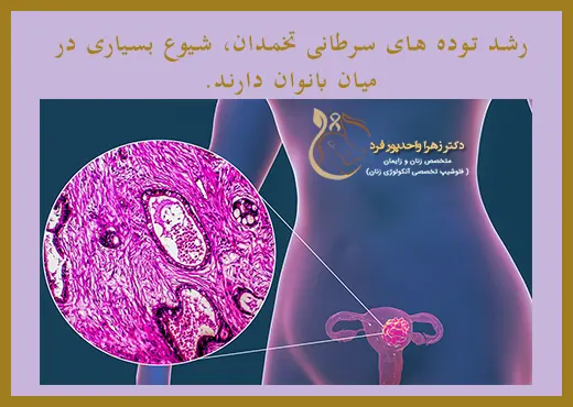 سرطان تخمدان در بیماری های شایع