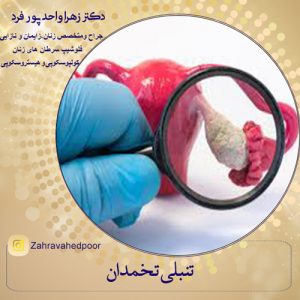 تنبلی تخمدان دکتر زهرا واحدپور