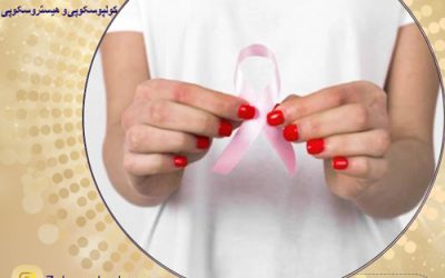 درمان سرطان رحم در کاشان با بهترین روش