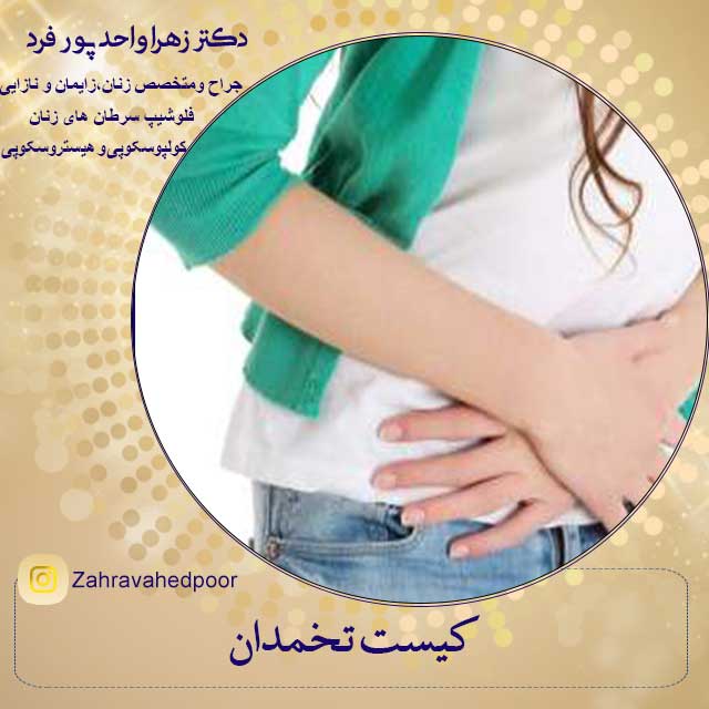 کیست تخمدان