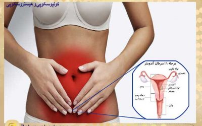 علت، علائم و تشخیص سرطان رحم