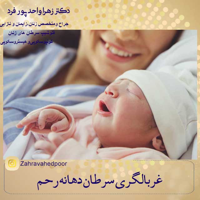زایمان-طبیعی