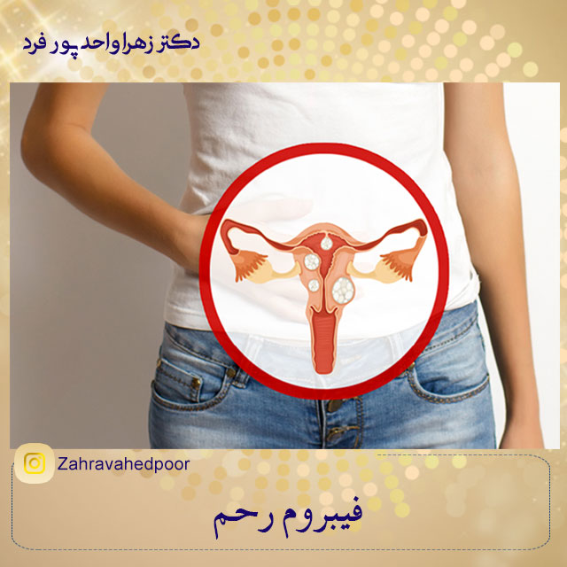 فیبروم-رحم