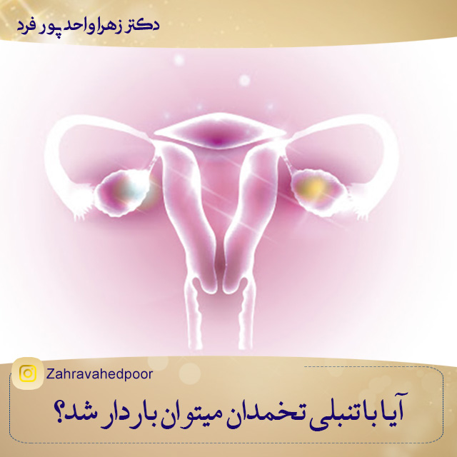 آیا با تنبلی تخمدان میتوان باردار شد؟