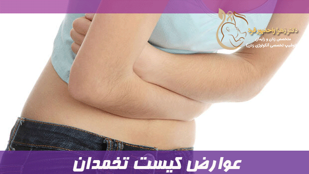 عوارض کیست تخمدان