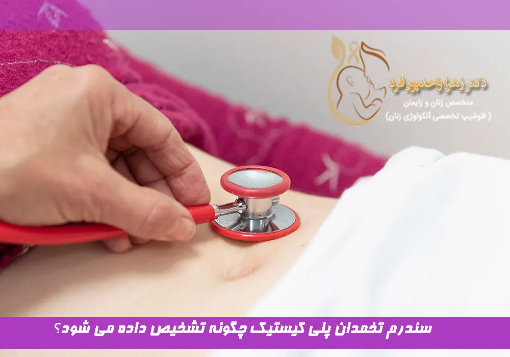 سندرم تخمدان پلی کیستیک چگونه تشخیص داده می شود؟